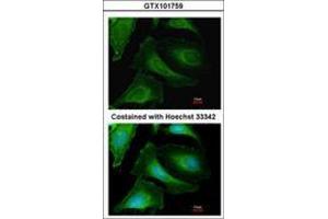 Image no. 3 for anti-Creatine Kinase, Brain (CKB) (AA 66-179) antibody (ABIN467367) (CKB antibody  (AA 66-179))