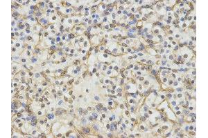 Immunohistochemistry (IHC) image for anti-Excision Repair Cross Complementing Polypeptide-1 (ERCC1) antibody (ABIN1876479) (ERCC1 antibody)