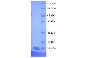 SDS-PAGE (SDS) image for Prostate Stem Cell Antigen (PSCA) (AA 21-95) protein (His tag) (ABIN5713764)