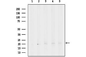 anti-Eukaryotic Translation Initiation Factor 1A, X-Linked (EIF1AX) (N-Term) antibody