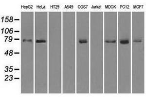 Image no. 2 for anti-Fermitin Family Member 2 (FERMT2) antibody (ABIN1499050) (FERMT2 antibody)