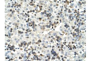 HSD17B6 antibody was used for immunohistochemistry at a concentration of 4-8 ug/ml to stain Hemopoietic cells (arrows) in Human Liver. (HSD17B6 antibody  (N-Term))