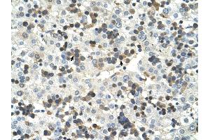 HSD17B6 antibody was used for immunohistochemistry at a concentration of 4-8 ug/ml to stain Hemopoietic cells (arrows) in Human Liver.