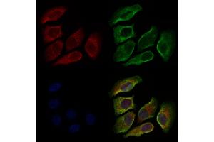 ABIN6264835 and ABIN6279045 staining Hela cells by IF/ICC. (RPL35A antibody  (N-Term))