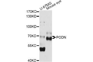 Western blot analysis of extracts of various cell lines, using PODN antibody (ABIN6290800) at 1:1000 dilution.