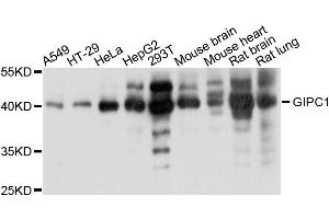 Western blot analysis of extracts of various cells, using GIPC1 antibody. (GIPC1 antibody)