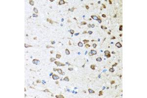 Immunohistochemistry of paraffin-embedded mouse brain using ACVR1C antibody at dilution of 1:100 (40x lens).