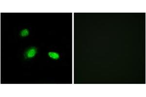 Immunofluorescence analysis of A549 cells, using HSPB2 Antibody.