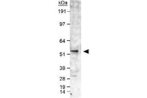 Western blot analysis of CYP19A1 in human fetal temporal lobe lysate using CYP19A1 polyclonal antibody . (Aromatase antibody  (AA 400-502))
