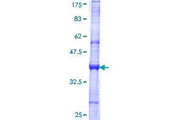 TTL Protein (AA 279-377) (GST tag)