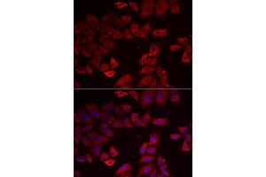 Immunofluorescence analysis of HeLa cell using SEPHS1 antibody. (SEPHS1 antibody)