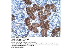 Rabbit Anti-DDC Antibody  Paraffin Embedded Tissue: Human Kidney Cellular Data: Epithelial cells of renal tubule Antibody Concentration: 4. (DDC antibody  (N-Term))