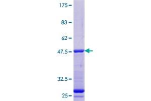 PFDN1 Protein (AA 1-122) (GST tag)