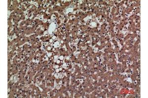 Immunohistochemistry (IHC) analysis of paraffin-embedded Human Liver, antibody was diluted at 1:100. (PSG1 antibody  (Internal Region))