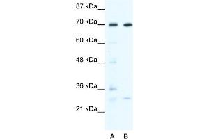WB Suggested Anti-WRNIP1 Antibody Titration:  0.