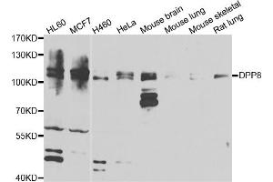 Western blot analysis of extracts of various cell lines, using DPP8 antibody (ABIN5974278) at 1/1000 dilution. (DPP8 antibody)