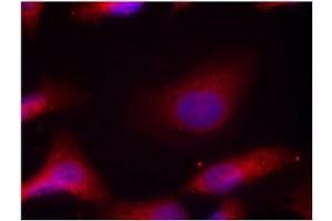 Image no. 3 for anti-Nuclear Receptor Coactivator 1 (NCOA1) (pTyr529) antibody (ABIN196876) (NCOA1 antibody  (pTyr529))