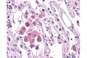 HNF1A antibody was used for immunohistochemistry at a concentration of 4-8 ug/ml. (HNF1A antibody  (N-Term))