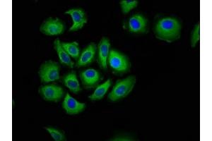 Immunofluorescence staining of A549 cells with ABIN7146237 at 1:133, counter-stained with DAPI. (Cadherin 7 antibody  (AA 146-296))