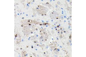 Immunohistochemistry of paraffin-embedded mouse brain using NMDA Rabbit mAb (ABIN7267420) at dilution of 1:100 (40x lens). (NMDAR2A antibody)