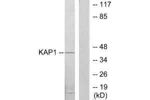 Western blot analysis of extracts from COLO205 cells, using KAP1 antibody. (KAP1 antibody  (Internal Region))