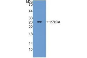 Detection of Recombinant ICA1, Human using Monoclonal Antibody to Islet Cell Autoantigen 1 (ICA1) (ICA1 antibody  (AA 1-258))