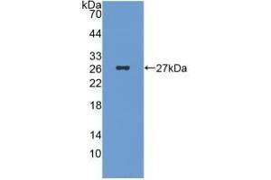 Detection of Recombinant ICA1, Human using Monoclonal Antibody to Islet Cell Autoantigen 1 (ICA1)