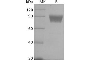 Western Blotting (WB) image for V-Set Domain Containing T Cell Activation Inhibitor 1 (VTCN1) (Active) protein (Biotin) (ABIN7319876) (VTCN1 Protein (Biotin))