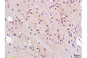 Formalin-fixed and paraffin embedded rat brain tissue labeled with Anti FBXW7/CDC4 Polyclonal Antibody, Unconjugated (ABIN1386103) at 1:200 followed by conjugation to the secondary antibody and DAB staining. (FBXW7 antibody  (AA 501-600))