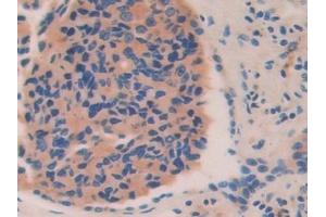 Immunohistochemistry (IHC) image for anti-Hexosaminidase B (Beta Polypeptide) (HEXB) (AA 122-311) antibody (ABIN7438553)
