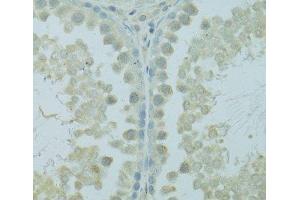Immunohistochemistry of paraffin-embedded Rat testis using HUS1B Polyclonal Antibody at dilution of 1:100 (40x lens). (HUS1B antibody)