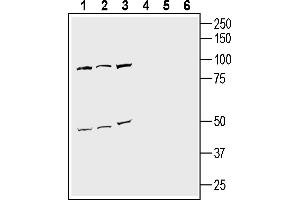 Western blot analysis of mouse Neuro-2a neuroblastoma cell line lysate (lanes 1 and 4), human SH-SY5Y neuroblastoma cell line lysate (lanes 2 and 5) and human  monocytic leukemia cell line lysate (lanes 3 and 6):1-3. (NPFFR2 antibody  (Extracellular))