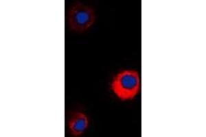 Immunofluorescent analysis of MUC13 staining in KNRK cells. (MUC13 antibody  (C-Term))
