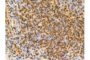 ABIN6257344 and ABIN6274221 at 1/100 staining Rat ovarian tissue by IHC-P. (MZF1 antibody  (N-Term))