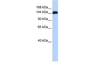 WB Suggested Anti-KIAA0182 Antibody Titration: 0. (GSE1/KIAA0182 antibody  (N-Term))
