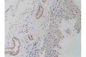 IHC-P analysis of Human Liver Tissue, with DAB staining. (ACTG2 antibody  (AA 3-376))