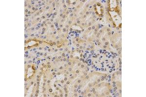 Immunohistochemistry of paraffin-embedded mouse kidney using PDHA1 antibody at dilution of 1:200 (x400 lens).