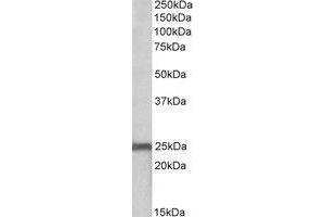 Western Blotting (WB) image for anti-NADH Dehydrogenase (Ubiquinone) Fe-S Protein 8, 23kDa (NADH-Coenzyme Q Reductase) (NDUFS8) (AA 196-206) antibody (ABIN793145)