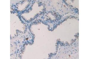 Detection of TPS in Human Prostate Gland Tissue using Monoclonal Antibody to Tryptase (TPS) (TPSAB1 antibody  (AA 161-262))
