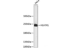 Western blot analysis of extracts of HeLa cells using HEATR1 Polyclonal Antibody at dilution of 1:3000. (HEATR1 antibody)