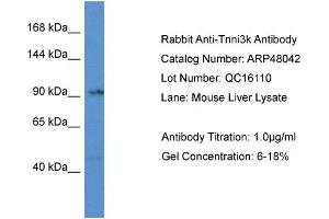 Western Blotting (WB) image for anti-TNNI3 Interacting Kinase (TNNI3K) (Middle Region) antibody (ABIN2783203) (TNNI3K antibody  (Middle Region))