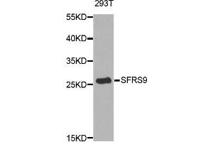 Western blot analysis of extracts of 293T cell line, using SFRS9 antibody. (SFRS9 antibody)