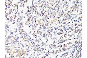 Immunohistochemistry of paraffin-embedded human tonsil using MTOR antibody (ABIN6292920) at dilution of 1:150 (40x lens). (MTOR antibody)