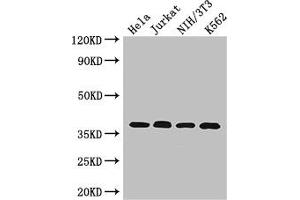 Western Blot Positive WB detected in: Hela whole cell lysate, Jurkat whole cell lysate, NIH/3T3 whole cell lysate, K562 whole cell lysate All lanes: RAD51 antibody at 2. (RAD51 antibody  (AA 1-228))