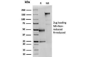 SDS-PAGE Analysis Purified Fodrin Mouse Monoclonal Antibody (SPTAN1/3351). (SPTAN1 antibody  (AA 2351-2475))