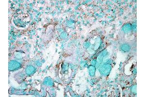 Immunohistochemistry analysis using Rabbit Anti-HSP70 Polyclonal Antibody . (HSP70 antibody  (FITC))