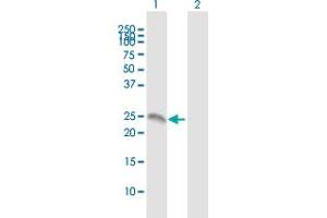 Western Blot analysis of ANXA2R expression in transfected 293T cell line by ANXA2R MaxPab polyclonal antibody. (Chromosome 5 Open Reading Frame 39 (C5orf39) (AA 1-193) antibody)