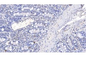 Immunohistochemistry (IHC) image for anti-Chromogranin A (CHGA) (AA 17-446) antibody (ABIN7443740)