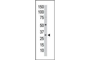 Image no. 1 for anti-Protein Phosphatase 1, Catalytic Subunit, gamma Isoform (PPP1CC) (N-Term) antibody (ABIN360759) (PPP1CC antibody  (N-Term))