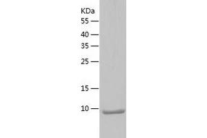 Western Blotting (WB) image for Deleted in Colorectal Carcinoma (DCC) (AA 841-941) protein (His tag) (ABIN7286147) (DCC Protein (AA 841-941) (His tag))